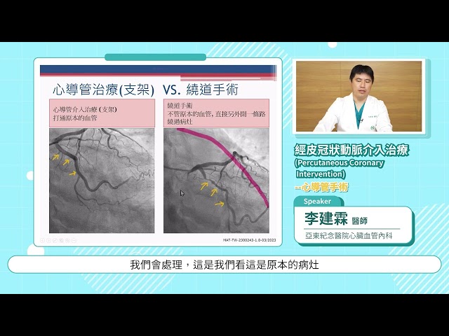 經皮冠狀動脈介入治療