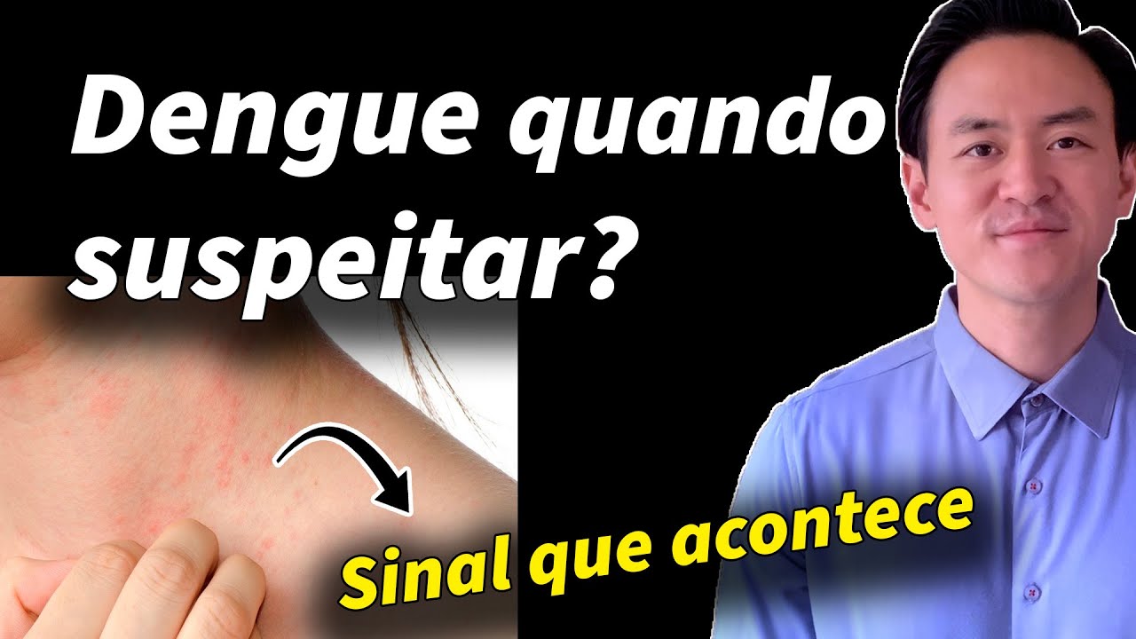 dengue como suspeitar?