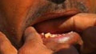 Local Dentist in Pushkar