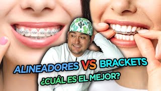 BRACKETS VS ALINEADORES DENTALES en 2022 - ¿ORTODONCIA INVISIBLE O TRADICIONAL 🔥