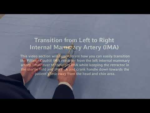 Pilling Couetil IMA Retractor Transition from Right IMA to Left IMA Instructional Video