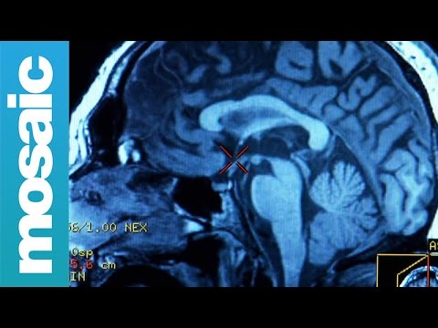 Last Chance Saloon (Part 4): Brain scans, clichés and complexity