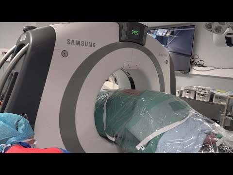 Scanner per-opératoire
