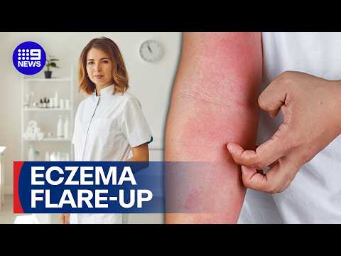 Dermatologists outnumbered by eczema patients, data reveals