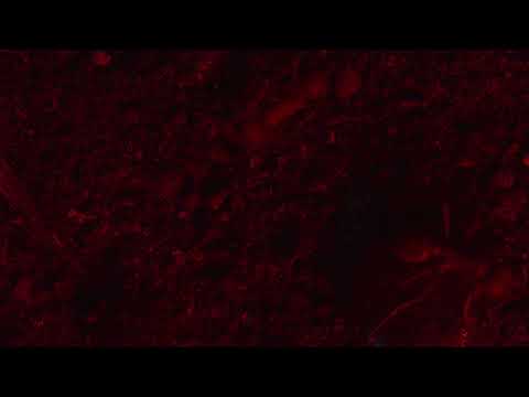 RESET (Clip)
