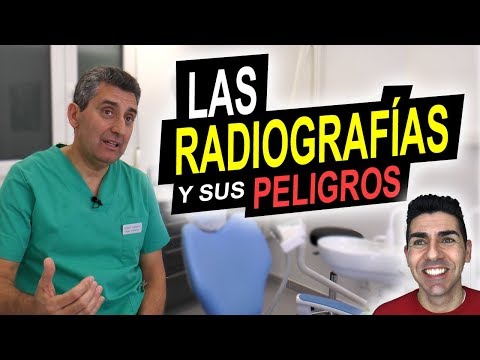 LAS RADIOGRAFÍAS Y SUS PELIGROS | ¿Producen cáncer? ¿Debemos evitar las radiografías dentales?