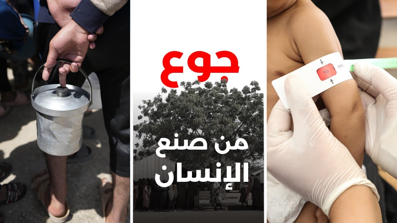  جوعٌ من صنع الإنسان: في غزة والسودان واليمن، تتباين الأزمات، لكن القصة واحدة
