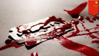 Hombre intenta fallidamente circuncidarse a si mismo siguiendo instrucciones en internet