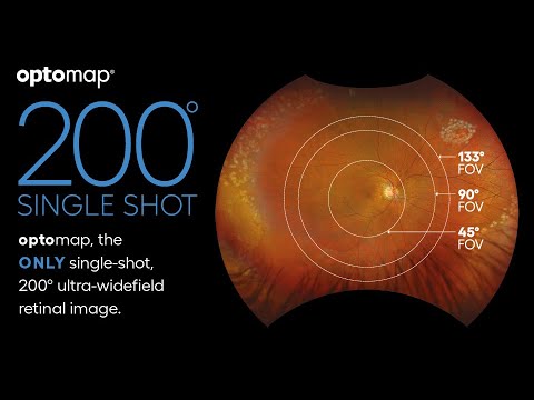 Field of View Matters