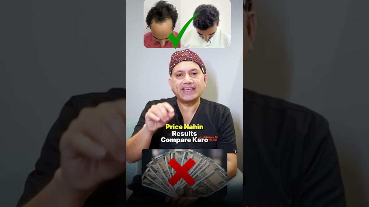 Turkey vs India Hair Transplant