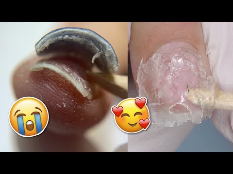 Damage FREE Soft Gel Nail Extensions Removal