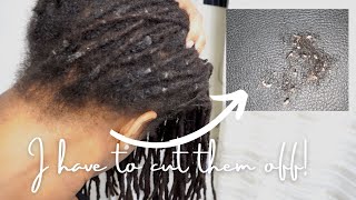 “I have to cut my locs off” | Buildup, Lint and How I Sadly got rid of it.