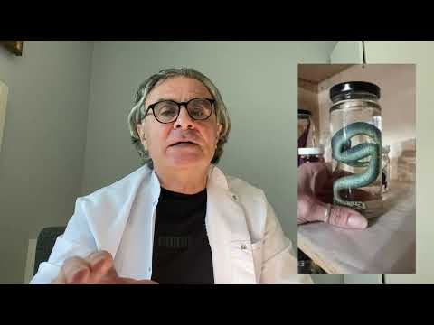 Endoskopi, Yılan yutulur mu?, Prof.Dr.Serdar Akgün