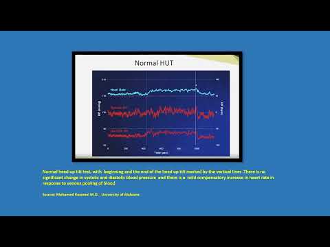Neurology Quiz #104  Autoimmune autonomic ganglionopathy (AAG)