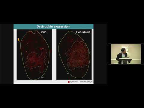 Nucleic Acid and Gene Delivery Systems by the Combination of Nanobubbles and Ultrasound