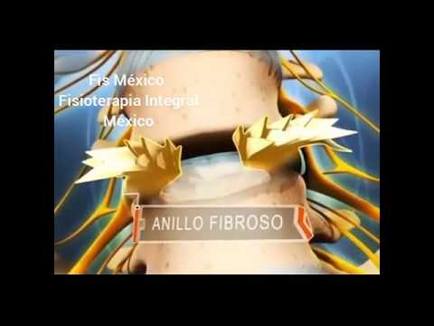 Saggio per il mal di schiena e La corretta immagine dellarticolazione della spalla