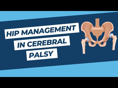 Hip Management in Cerebral Palsy