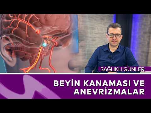 Anevrizma Sessizce Öldürebilir! İşte Bilmeniz Gerekenler | Sağlıklı Günler