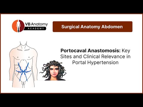 Portocaval Anastomosis: Key Sites and Clinical Relevance in Portal Hypertension