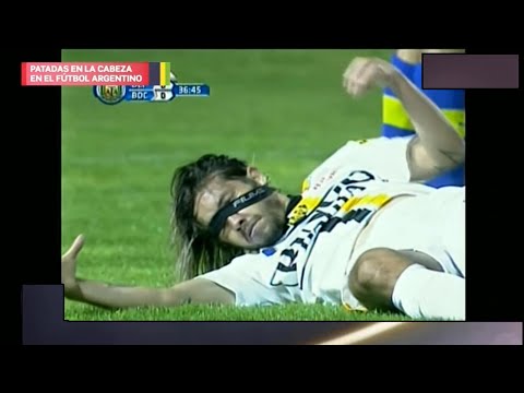 Special Headbutts in Argentine Football - PG 2022