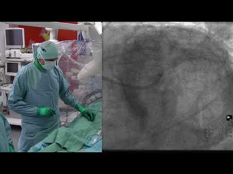 PCR In The Lab Webinar - Left main bifurcation PCI – proper use of imaging guidance