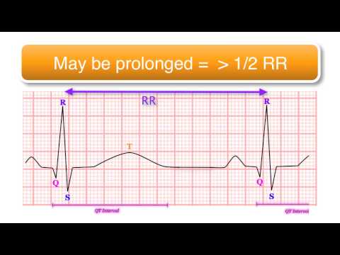 ECG basics 10/10 - The QT Interval