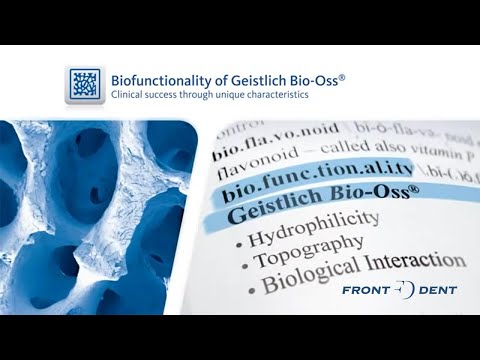 Miben különbözik a Bio-Oss csontpótló versenytársaitól?