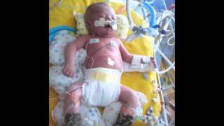 Prayers for Aiden Isaac Loy