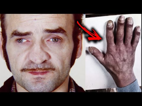 One of The Worst Humans To Ever Exist - Fritz Honka 