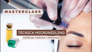 Masterclass especial manchas y marcas (técnica microneedling)