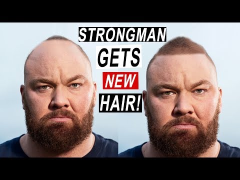 download lagu mp3 mp4 Hafthor Bjornsson Hair Transplant, download lagu Hafthor Bjornsson Hair Transplant gratis, unduh video klip Hafthor Bjornsson Hair Transplant