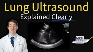 Download Lagu Lung Ultrasound Explained (Point of Care, Bedside, Clinical) Thumbnail