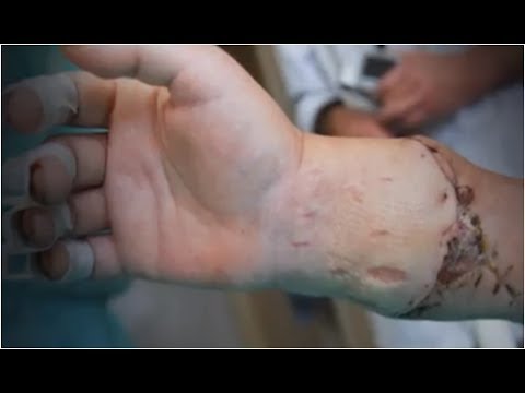 Zwiększenie elementu za pomocą wazeliny Penis arabski technika rozszerzenie