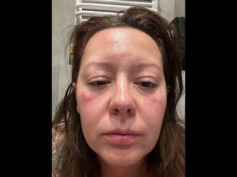 Makijaż na twarzy z AZS