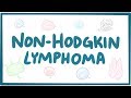 Non-hodgkin lymphoma - causes, symptoms, diagnosis, treatment, pathology