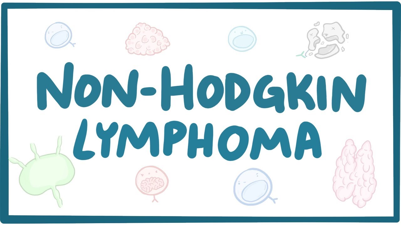 Non-hodgkin lymphoma - causes, symptoms, diagnosis, treatment, pathology