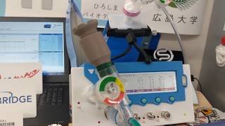 ?-VENTが動かなくなった時の対処法