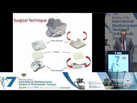 Atay T - Ankle arthroplasty. Indications and technique