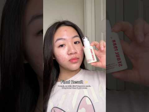 trying the viral ksecret seoul 1988 retinal serum for 7 days!!