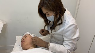 【Thread Lifting 自然提拉】