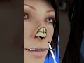 Transform Your Nose with Rhinoplasty #shorts - Creativelearning3d
