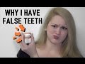 MY DENTURES | Bethany Wilhelm