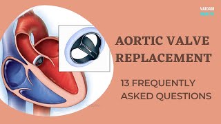 Aortic Valve Replacement - 13 Frequently Asked Questions