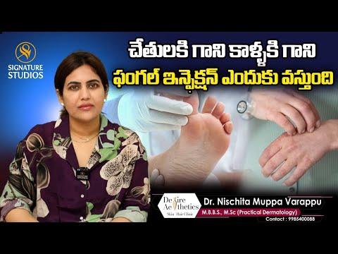 REASONS FOR FUNGAL INFECTIONS | DR NISCHITA MUPPAVARAPU | DESIRE ASTETICS | Signature Studios