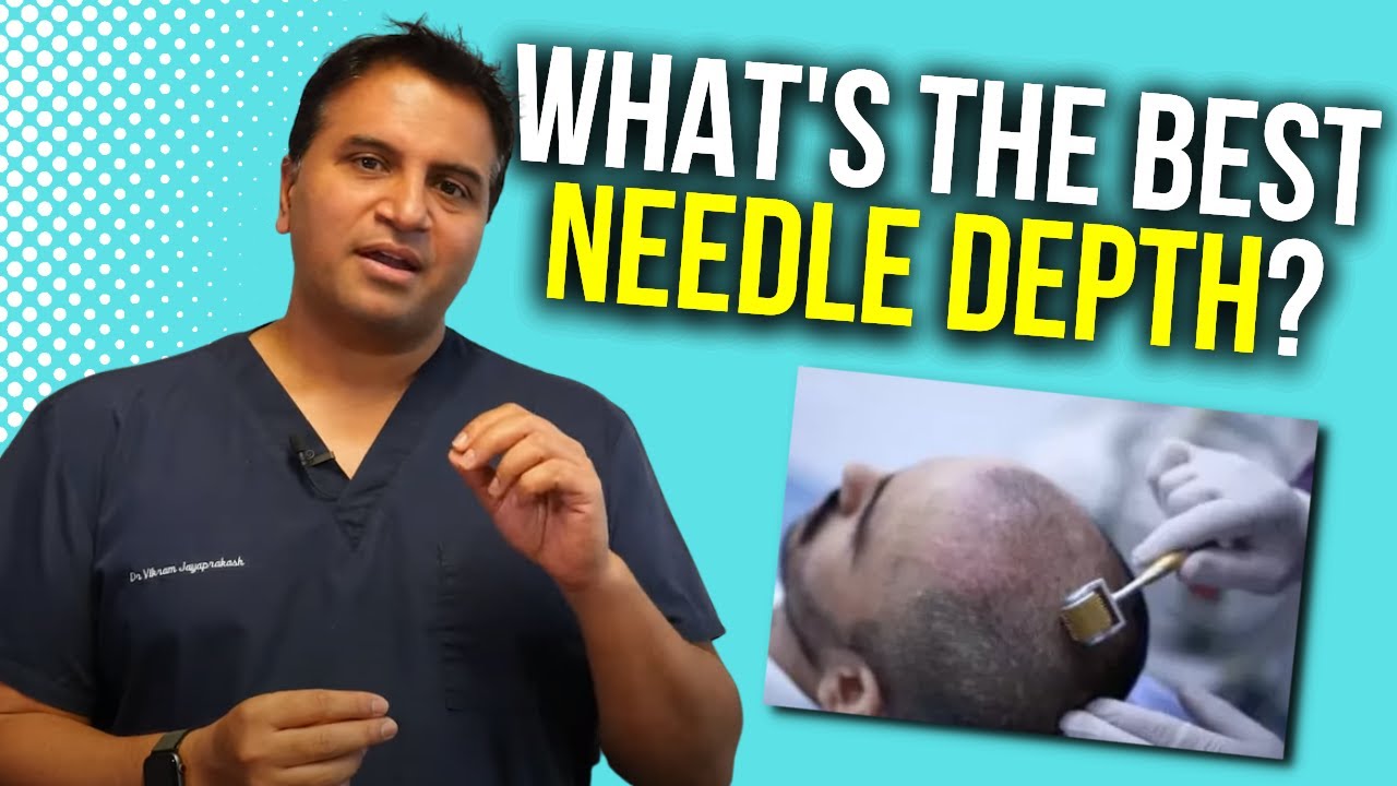 Derma-rolling: Optimal Needle Depth | The Hair Loss Show