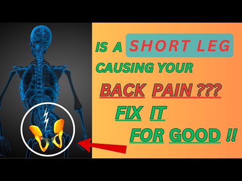 Is a SHORT LEG Causing Back Pain??  FIX IT FOR GOOD | Dr. Frank Altenrath Chiropractor in Cresskill
