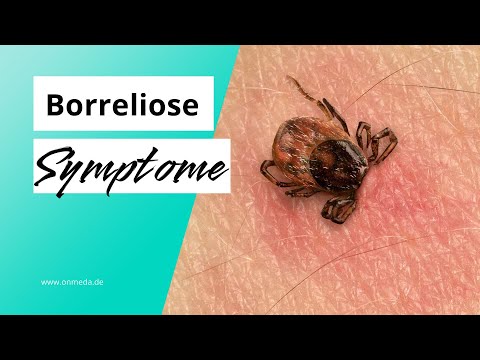 Borreliose: Mögliche Symptome der Krankheit