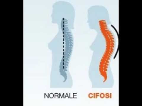 Legamento collaterale del ginocchio Norma angoli articolazioni dellanca ultrasuoni nei bambini