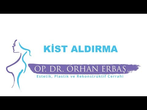 Kist Aldırma İşlemi