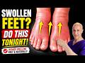 Swollen Feet?  DO THIS Tonight!   Dr. Mandell